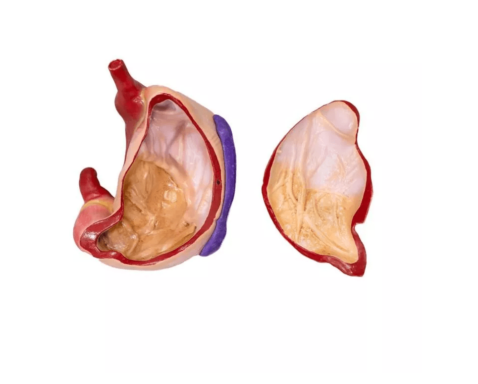 Schweinemagenmodell, 2 Teile, 1/3 natürliche Größe - Erler - Zimmer